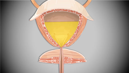 Urinary Continence Management — Altura Learning